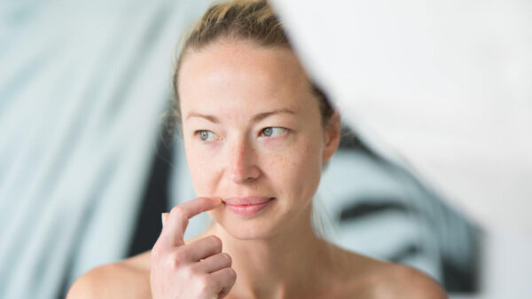 manchas en el bigote mujer