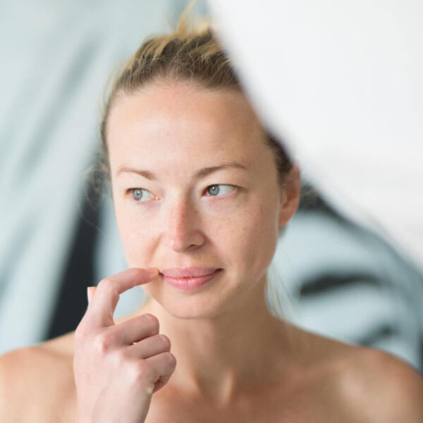 manchas en el bigote mujer